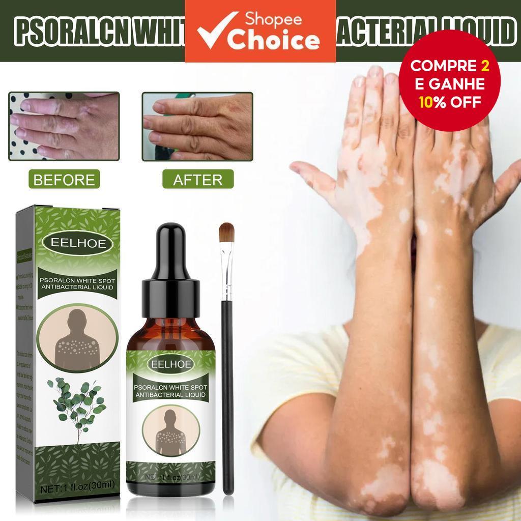 Manchas de Pigmentação no Rosto: Onde Comprar | BuscaProdutos