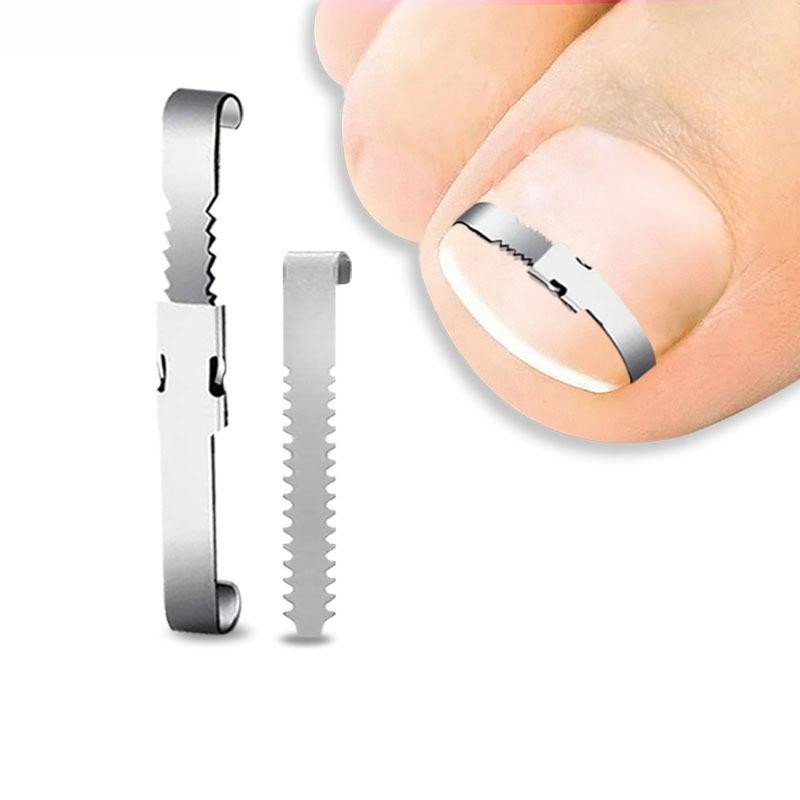 Ferramentas para Corrigir Unhas Encravadas, Pedicure, Terapia para os Pés, Tratamento de Recuperação, Ferramentas de Cor
