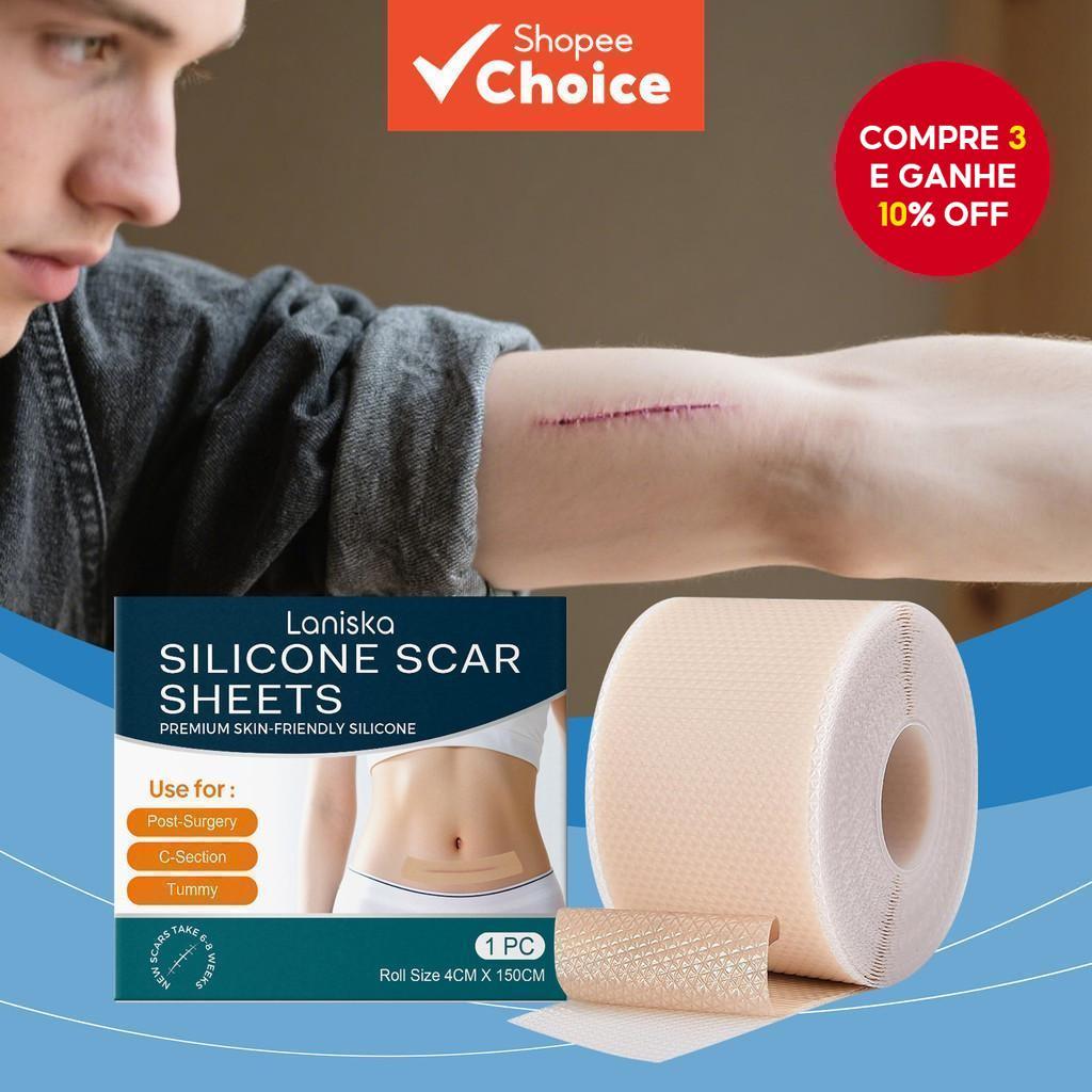 Fita de Silicone Antiadesiva para Cicatrizes: Solução Suave para Cuidados com Cicatrizes Cirúrgicas, de Acne e Fita de Silicone Antiadesiva para Cicatrizes: Solução Suave para Cuidados com Cicatrizes Cirúrgicas, de Acne e