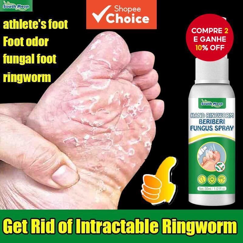 Spray Antifúngico para Pé de Atleta South Moon 30ml - Alívio de Pé de Beribéri, Tratamento Antissimose, Antissudorífero,