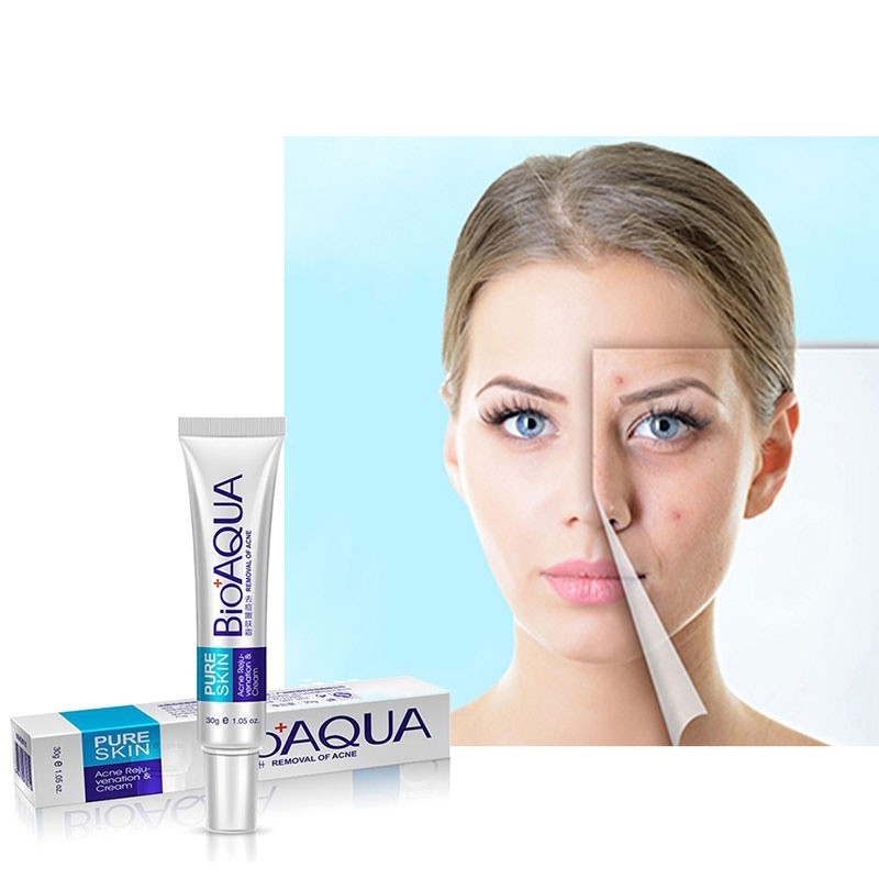 Creme Para Remoção De Cicatrizes De acne/Tratamento anti-Clareador/Controle De Oleosidade/Cravos De Poros
