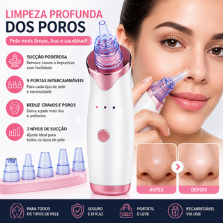 Sugador de Poros Recarregável – Sucção Forte a Vácuo USB para Cravos, Acne e Limpeza Profunda