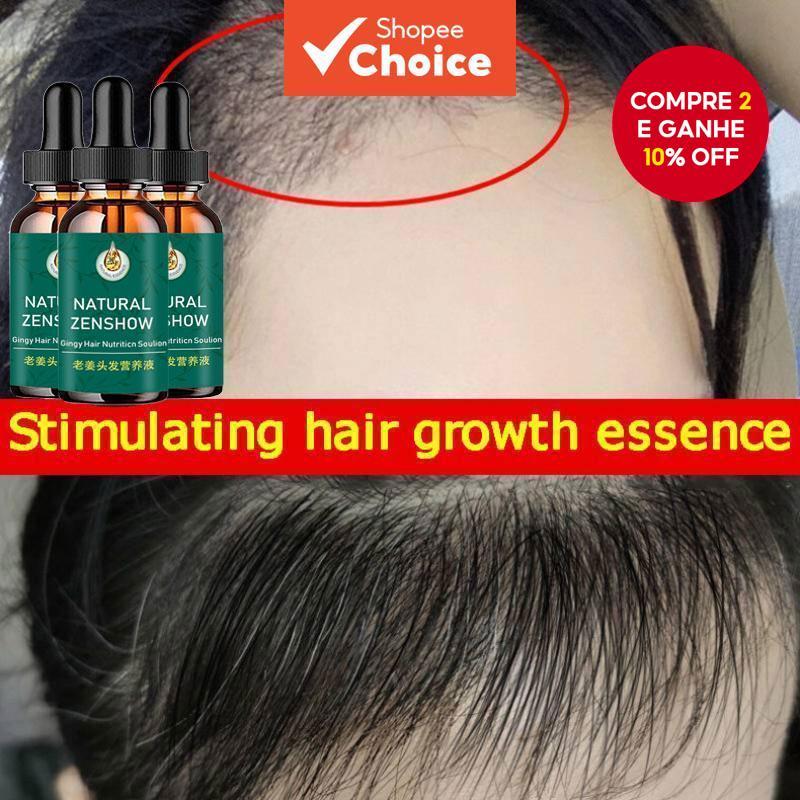 África Óleo Essencial K3X4 Para Crescimento de Cabelos Capilar Tração Louco Gengibre Selvagem Prevenir Alopecia