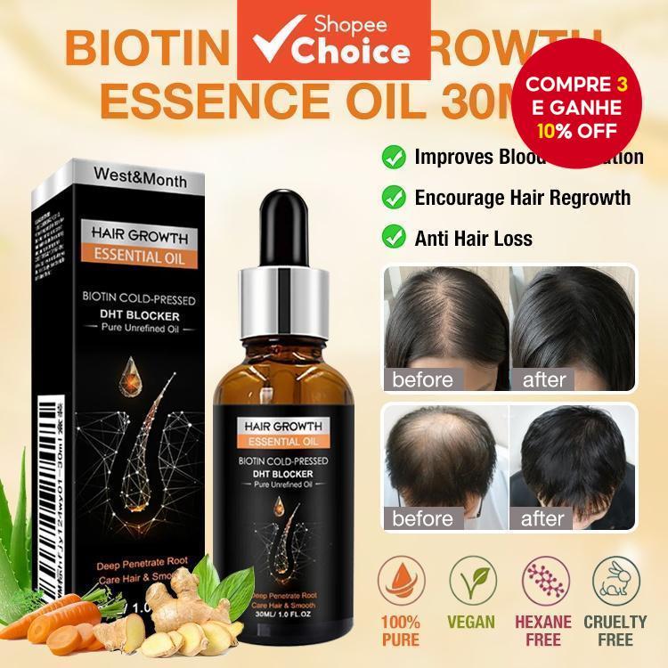 Sérum Essencial para Crescimento Capilar: reduz caspa, coceira e fungos, mantendo cabelos fortes e saudáveis - 30ml. em Oferta na Shopee
