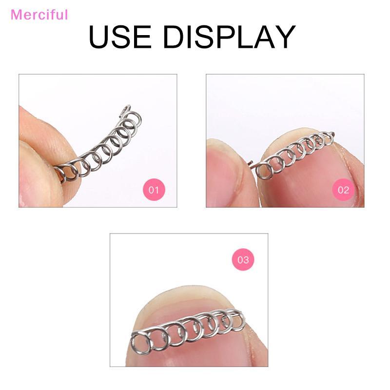 [Mer] Fixador De Ferramenta Para Unhas De Pé Correção Spring Onyxis Corretor De Joanete Dos Pés VN