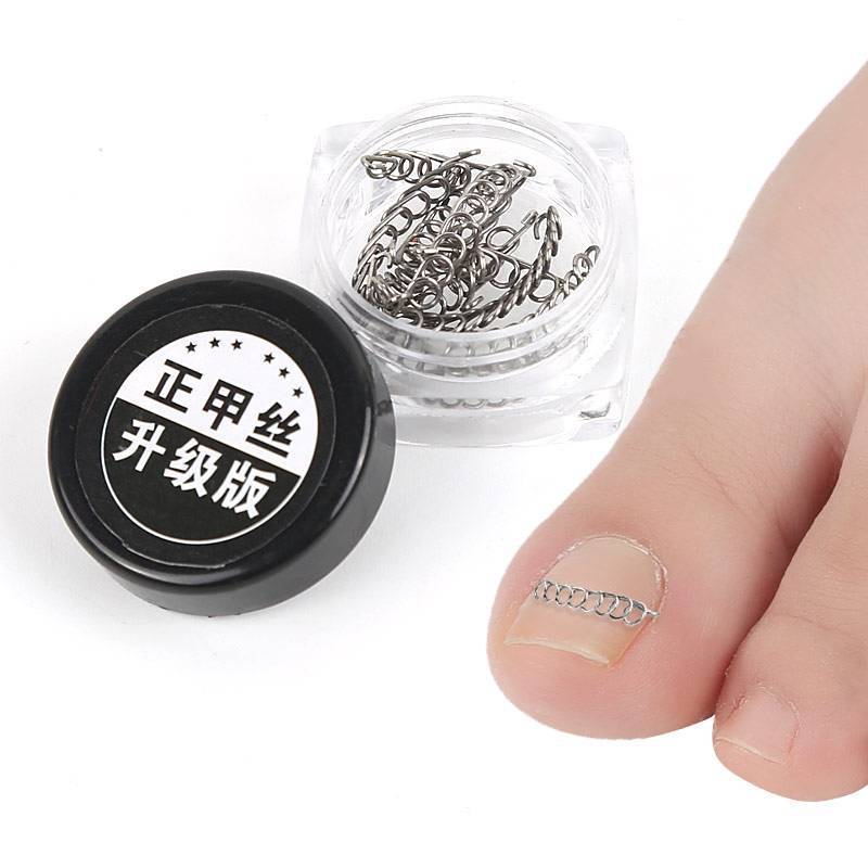 EA & Moda Fixer Foot Nail Tool Correção Spring Onyxis Corretor De Joanete Para Unhas Dos Pés .
