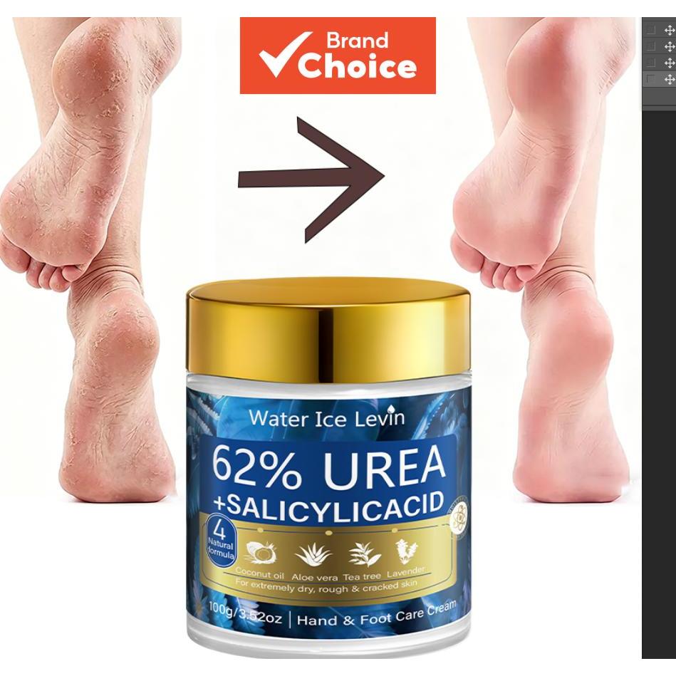 Creme para Mãos e Pés à Base de Ureia 62% e Ácido Salicílico Levin, para Pele Ex