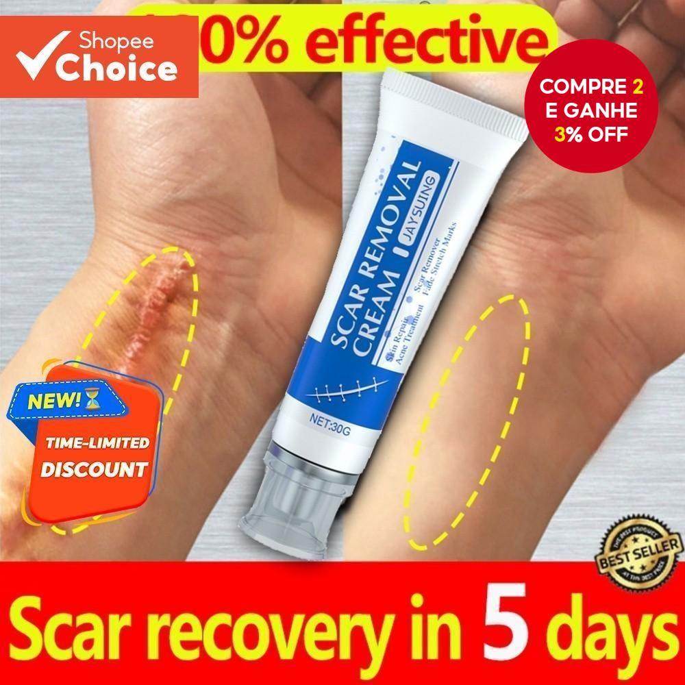 Advanced Scar 30g Creme Reparador Com Centella , Manteiga De Karité E Esqualano-Seguro Para Gravidez Adequado Crianças ,