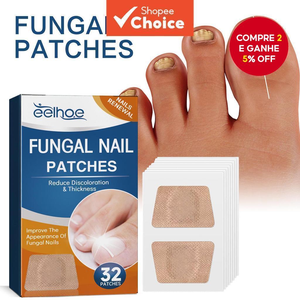  32 peças adesivo de correção de unhas dos pés para fungo cinza, unhas grossas, unhas encravadas e infecções parônicas