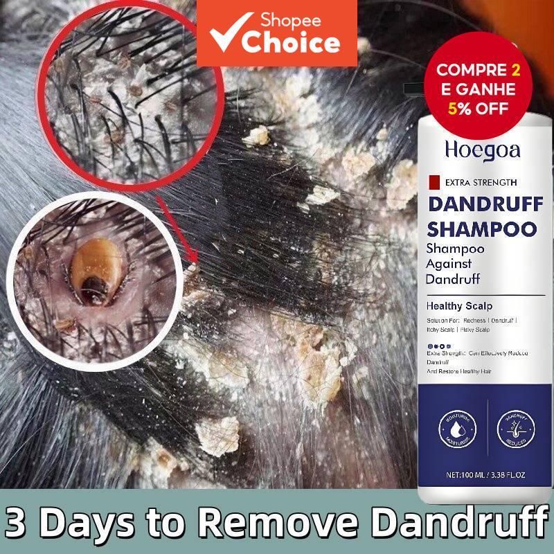 Shampoo Anticaspa & Anticaída 100ML com Extratos Vegetais, Fortalece Cabelos Finos, Acalma Couro Cabeludo com Uso