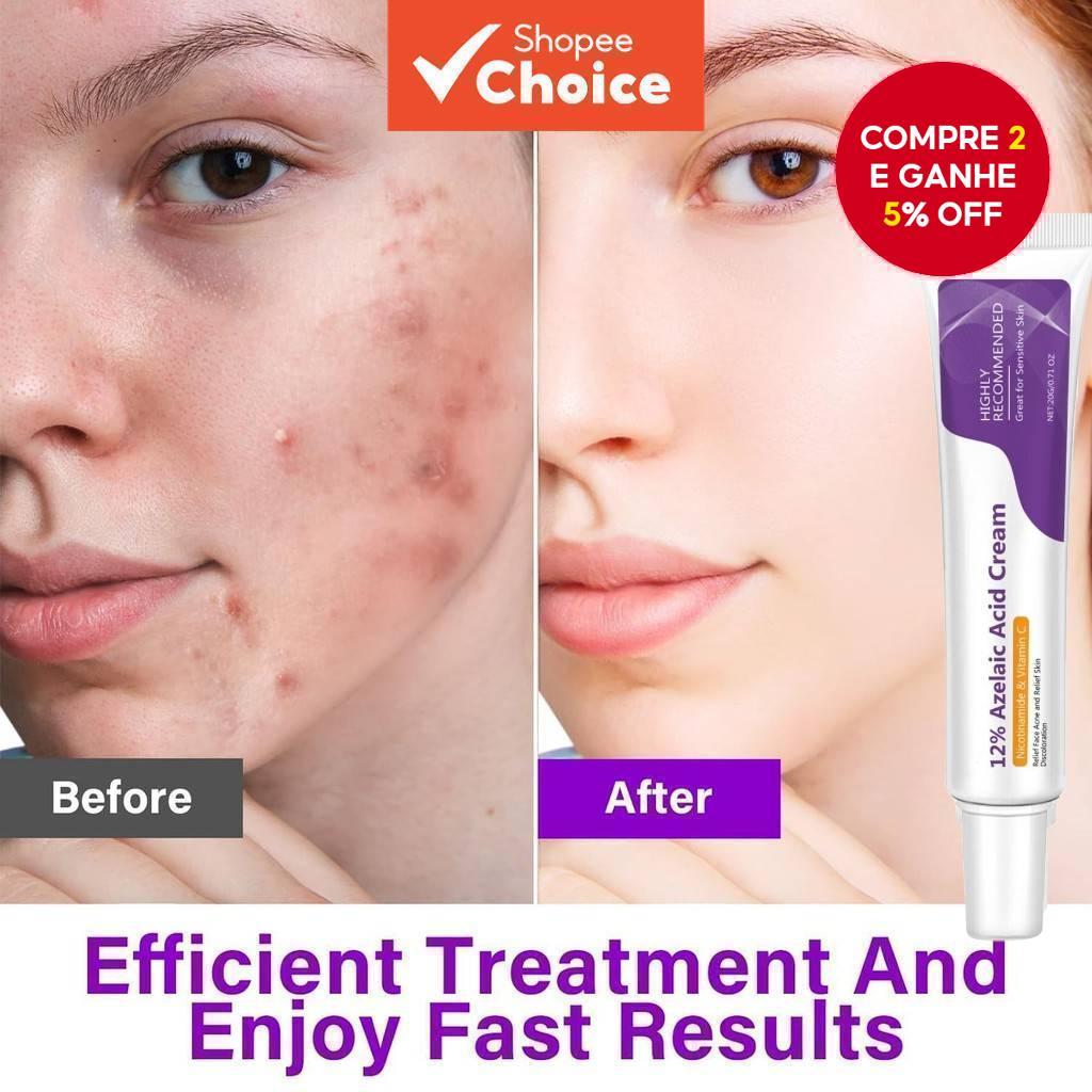 Creme Facial Ácido Azelaico Niacinamida Vitamina C