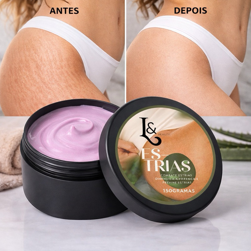 Creme Redutor De Estrias Trata E Previne 150g - L&Beauty