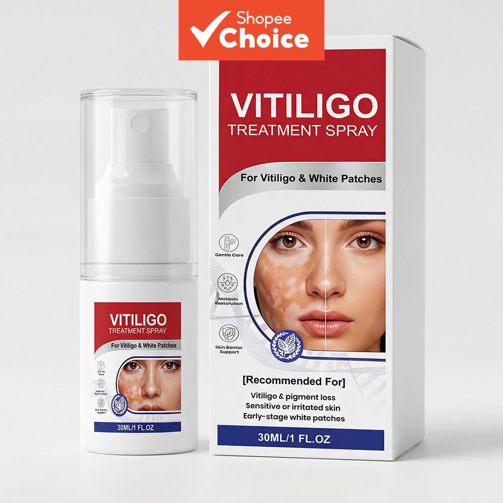 Spray Avançado de Pigmento Dedicado 30ml com Carbômero & Arginina – Para Vitiligo & Manchas Brancas na Barreira Cutânea