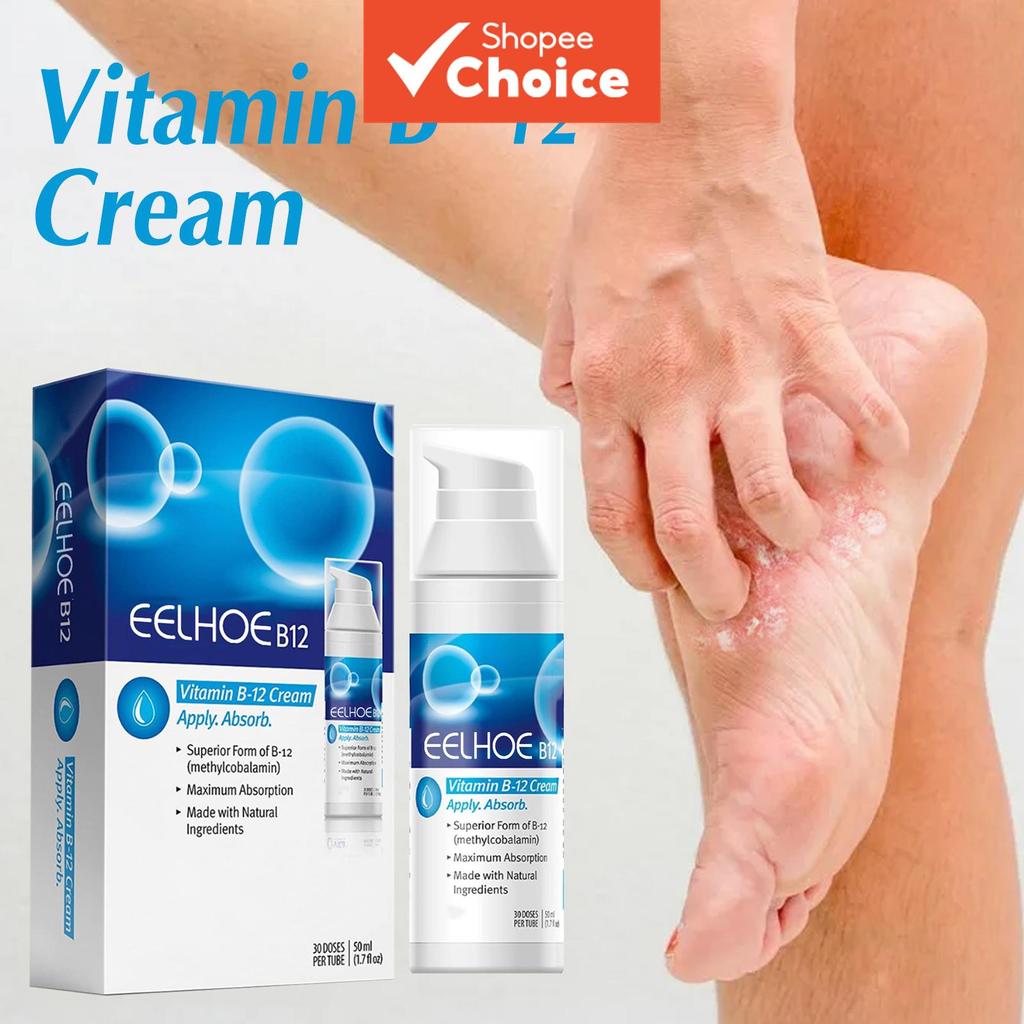 Creme Vitamina B12 para Psoríase e Dermatite 50 ml – Alivia coceira, vermelhidão e descamação; cuida de áreas secas e