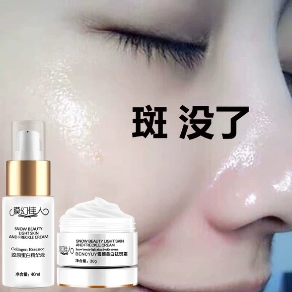 Membrana beleza creme de remoção de sardas beleza mágica genuíno manchas de desbotamento clareamento creme de remoção de