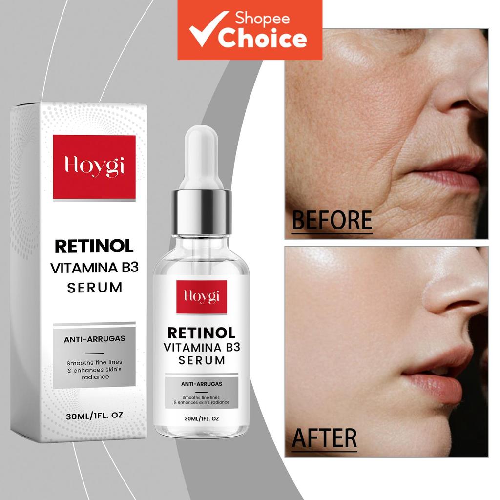 Sérum Hidratante Anti-Envelhecimento 30ml – Retinol & Niacinamida para Firmeza e Elasticidade | Hidratação de Longa
