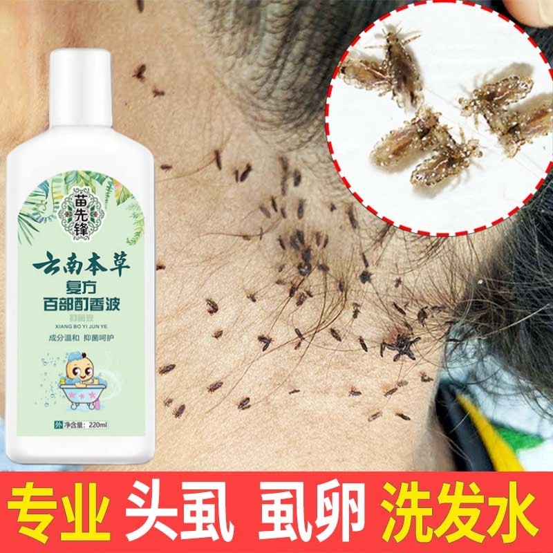 Yunnnan Materia Medicina Remover Piolhos Shampoo Cem Peças Tintura Shampoo Menina Long Piolhos Medicina Crianças Corte d