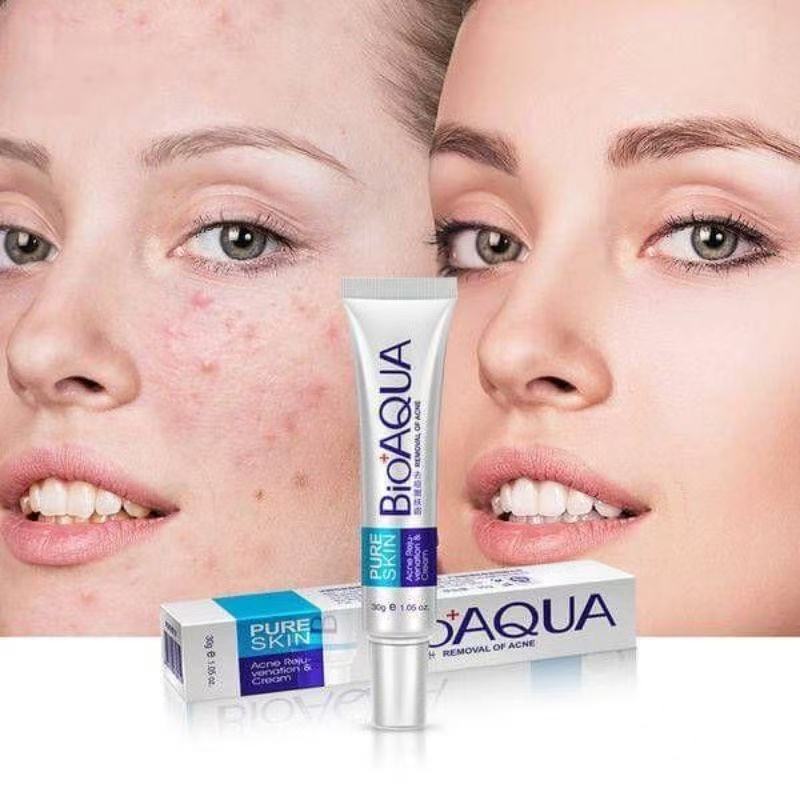 Creme Natural do reparo da remoção da acne do extrato da planta melhora a vermelhidão da pele da acne ilumina a pele Fac
