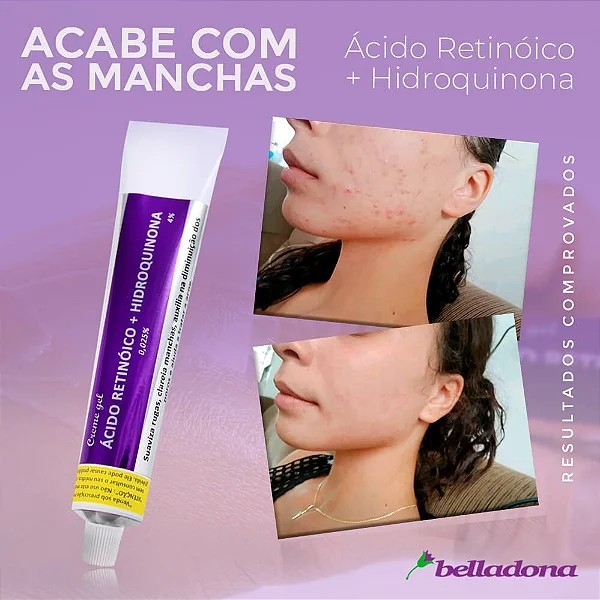 Kit com 2x Gel Creme Peeling Belladona Anti-Melasma 30g - Original Belladona em Oferta na Shopee