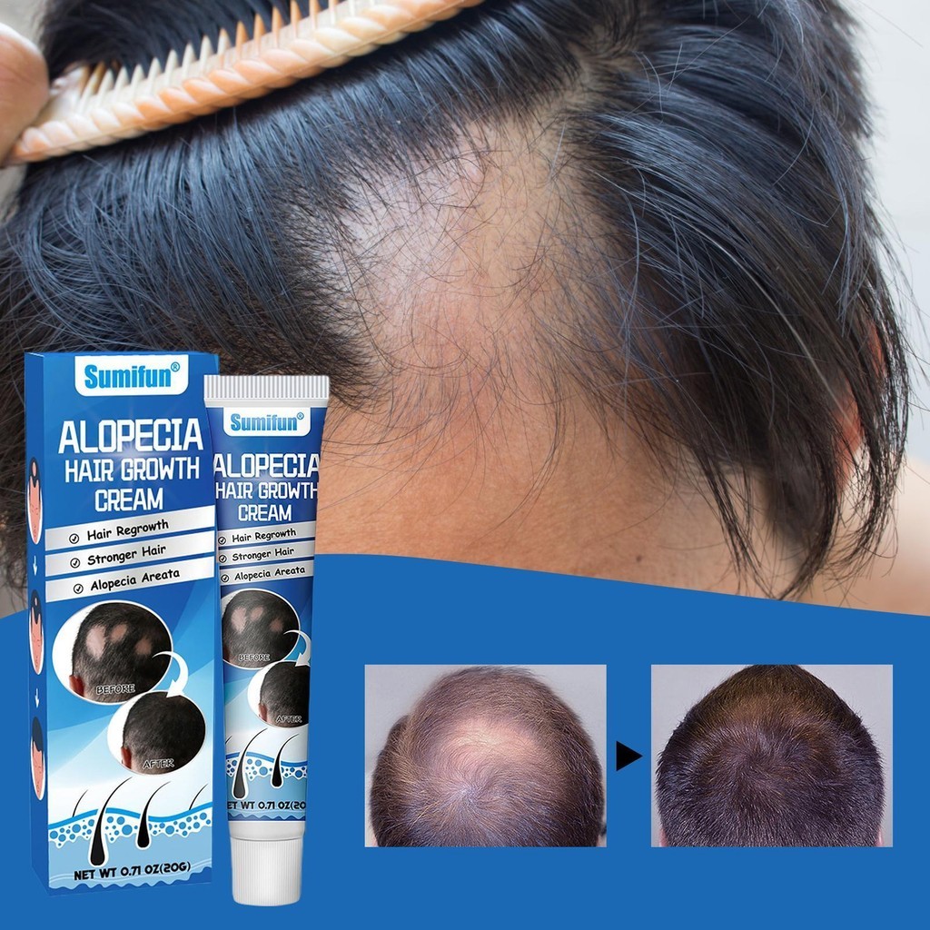 Aume: Guia Completo e Onde Comprar | BuscaProdutos