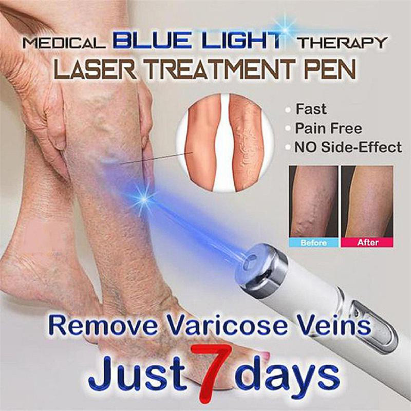 Caneta De Tratamento Azul Transparente De 1 Unidade Para Varizes/Laser Antirrugas/Acne em Oferta na Shopee