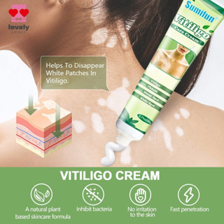 Creme de Tratamento de Manchas Brancas Sumeifen para Redução de Manchas Brancas e Cuidados com a Pele Vitiligo Cor Viole em Oferta na Shopee