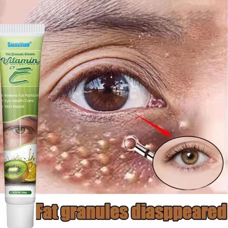 Creme para os Olhos para Remover Grãos de Sebo, Elimina Eficazmente o Inchaço, Anti-Milia, Produto de Cuidado e Reparaçã
