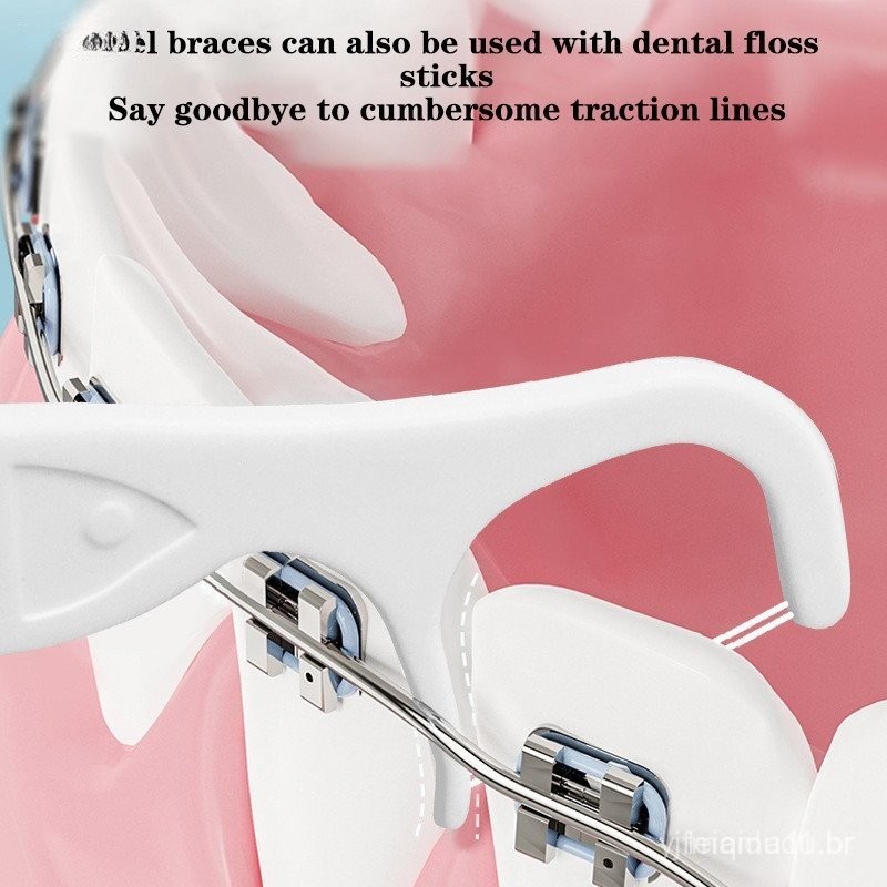 100 pcs/saco de Fio Ortodontico para Pacientes com Aparelhos Dentários