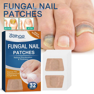 32 Adesivos para Tratamento de Unhas Anti-Fúngicas, Reparação de Onicomicose 2026 QHPT