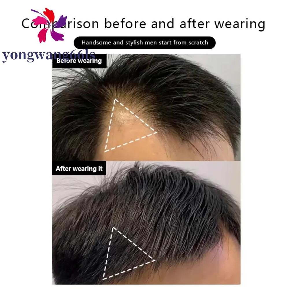 YONGWANG 100 % Peruca De Cabelo Humano , Costeletas , Pele Ultrafina , Remendo De Testa PU , Sem Costura em Oferta na Shopee