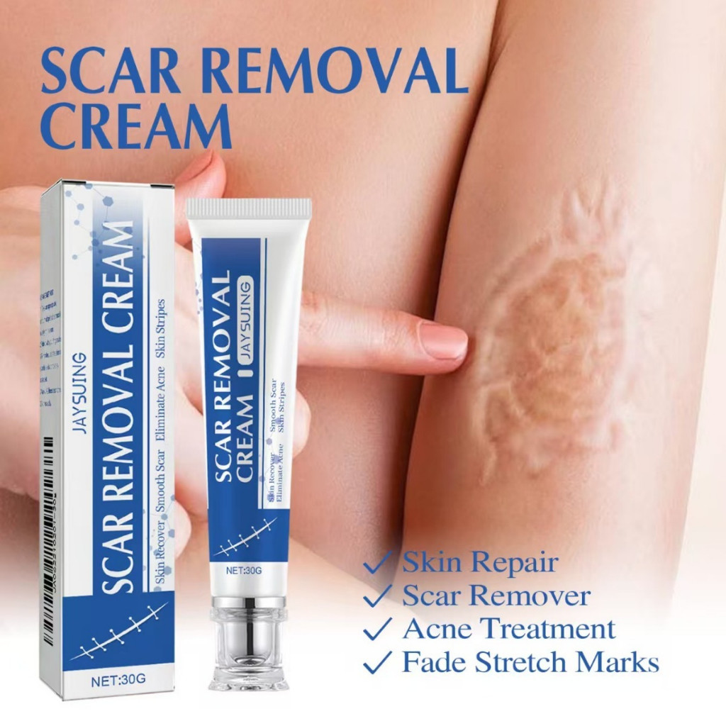 Creme Reparador De Cicatrizes Para Cicatrizes Cirúrgicas, Estrias, Acne, Cicatrizes Antigas E Novas, Etc. em Oferta na Shopee