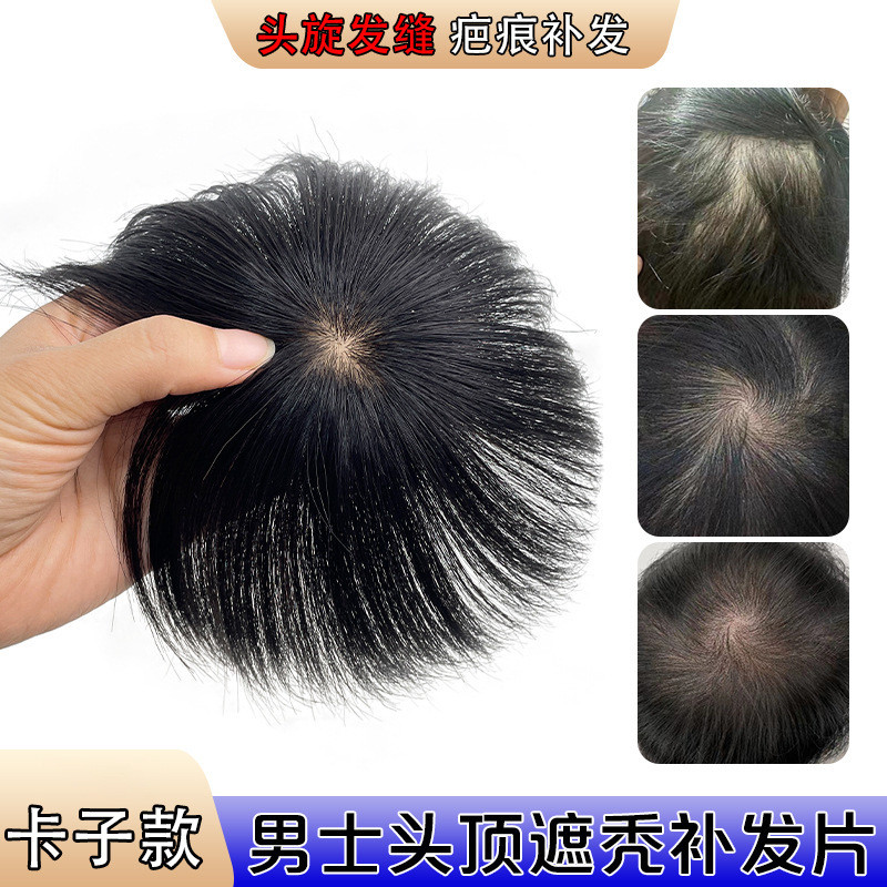 Substituição ciclone fofo peruca masculina luz fina peça de cabelo volta cabeça superior cabeça masculina superior adici
