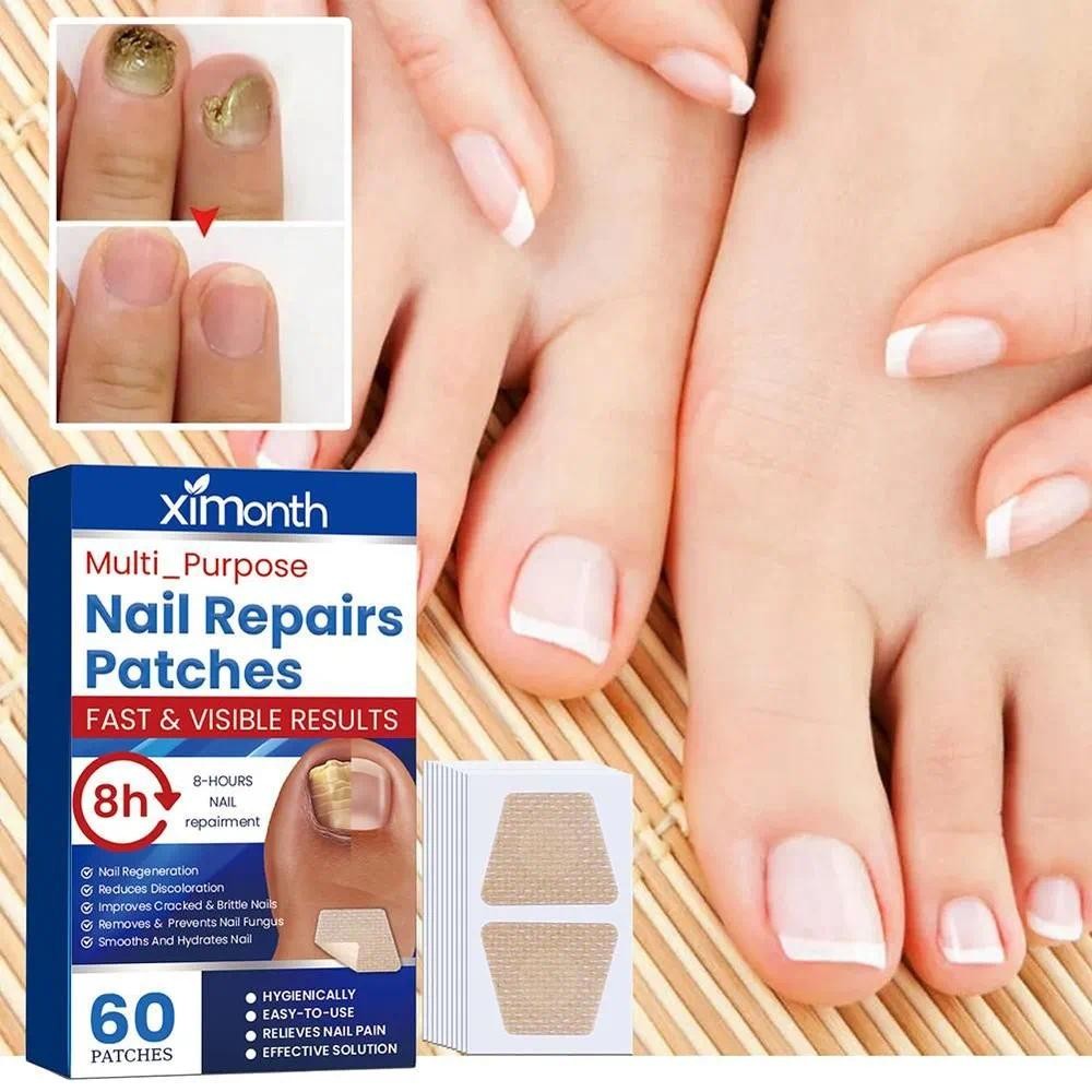60 Adesivos para Unhas com Fungicida