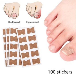 100 Unidades Adesivo Para Fungos Nas Unhas Pegajoso Reparo De Correção Encravada Cuidados Com As Paroníquia Reme em Oferta na Shopee