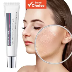 Creme Clareador de Manchas com Ácido Azelaico 15% LEVIN 20g/0,70oz, Aplicação Direta para Apagar Marcas Escuras e
