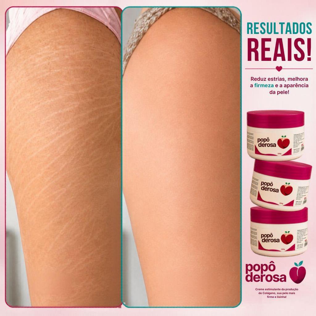 Popoderosa Creme Corporal Termoativo para Estrias e Celulite 200g Efeito Aquecimento