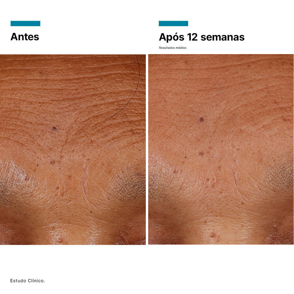 Detalhes do Sérum Volumizador SkinCeuticals HA Intensifier Multi Glycan Correção 30ml