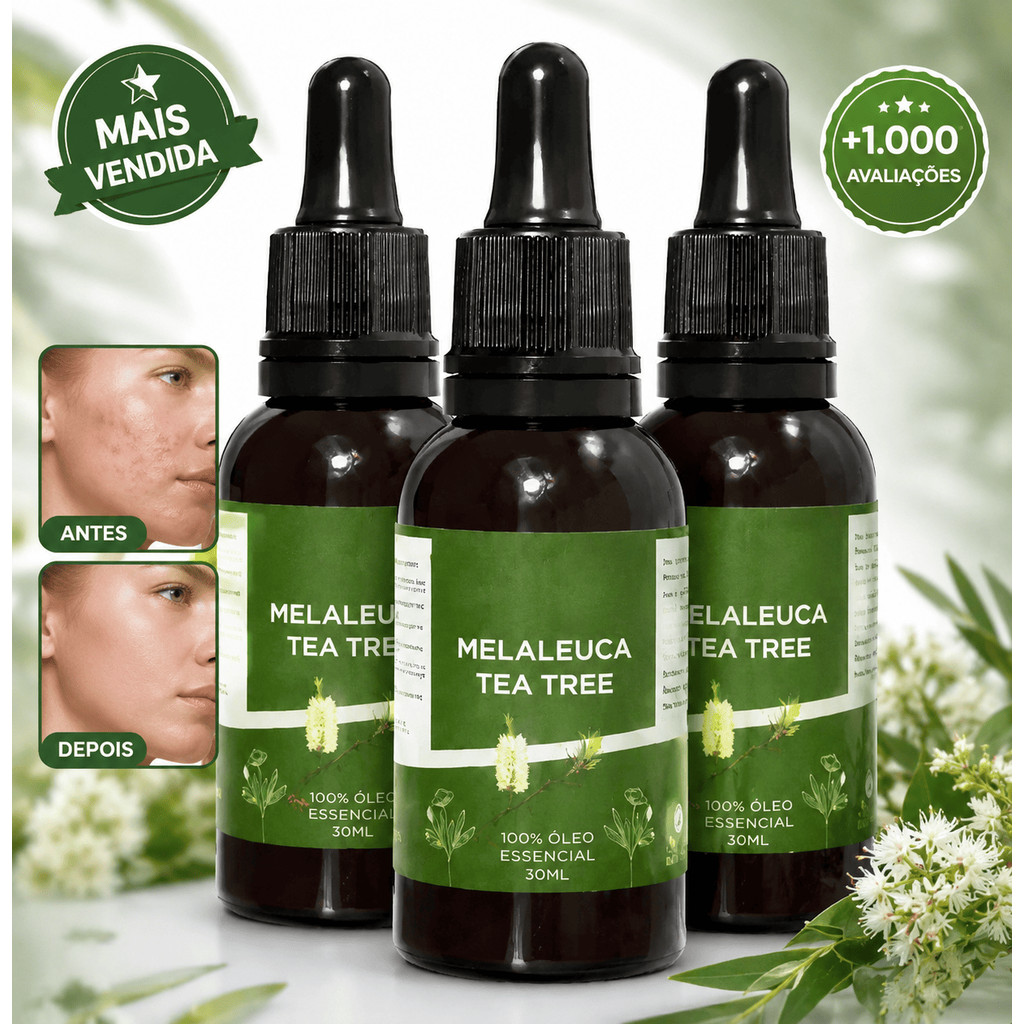 Óleo Essencial De Melaleuca 100% Puro 30ml Contra Micose e Acne ENVIO RÁPIDO!!
