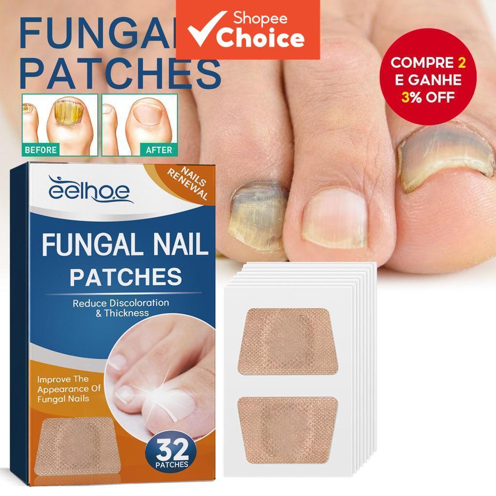 Adesivos Para Unhas Fúngicas EELHOE | Tratamento De Fungos Nas , Reparo De Descoloração , De Renovação De