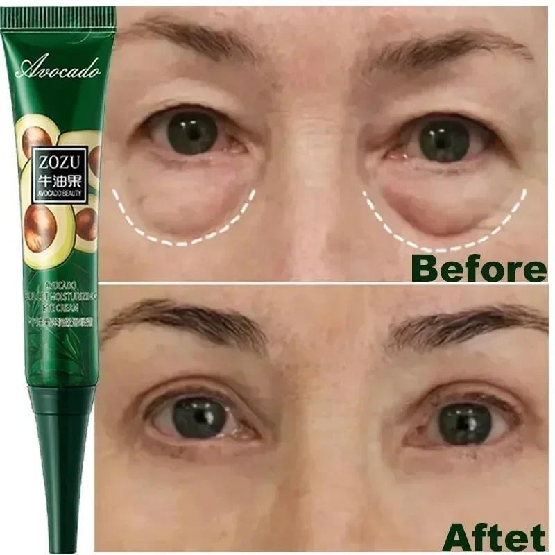 Creme instantâneo anti-rugas para os olhos, anti-olheiras, bolsas nos olhos e produtos