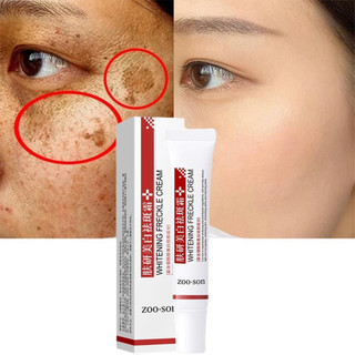 Creme Clareador Para Remover Melasma/Manchas Escuras/Melã/Brilho