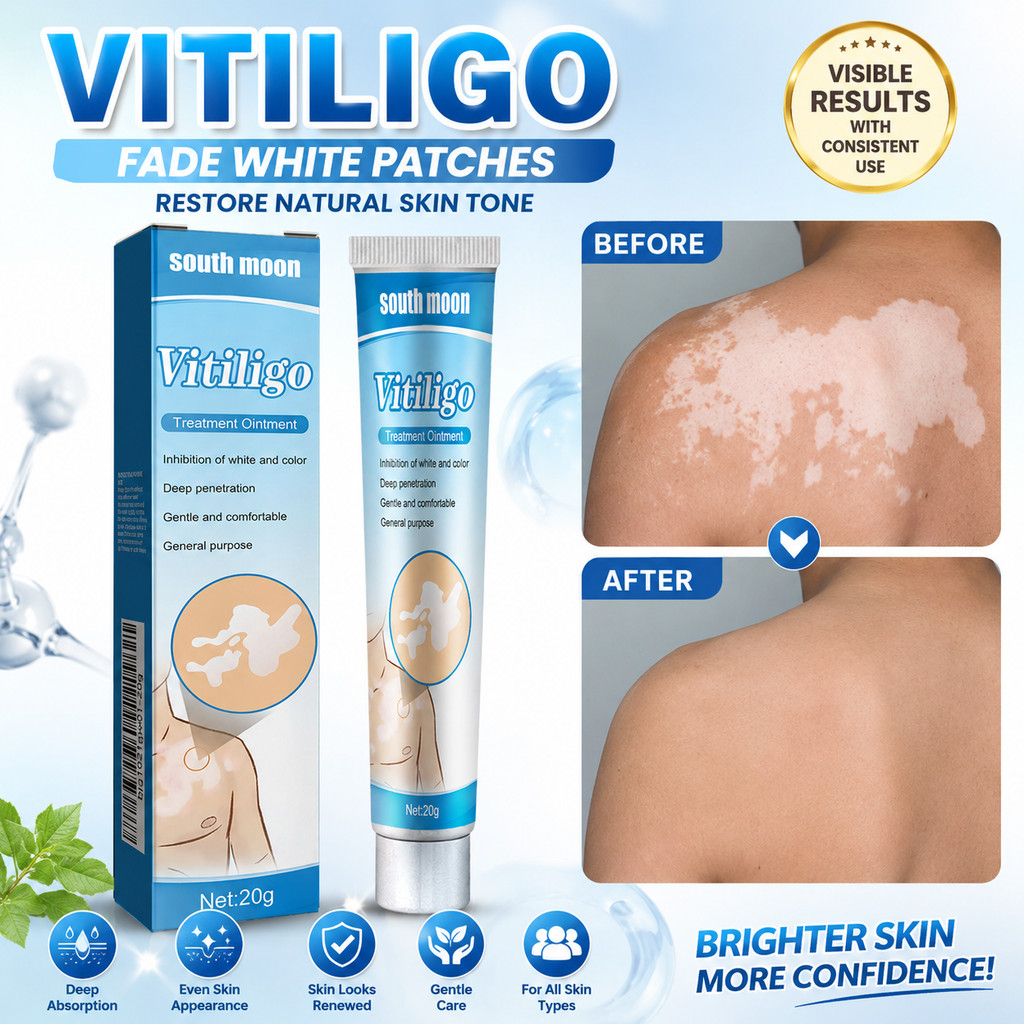 TUOP Advanced (1 Unidade/2 Unidades/3) Pomada para a Pele com Manchas Brancas South Moon 20g - Apoio para Vitiligo, Cuid
