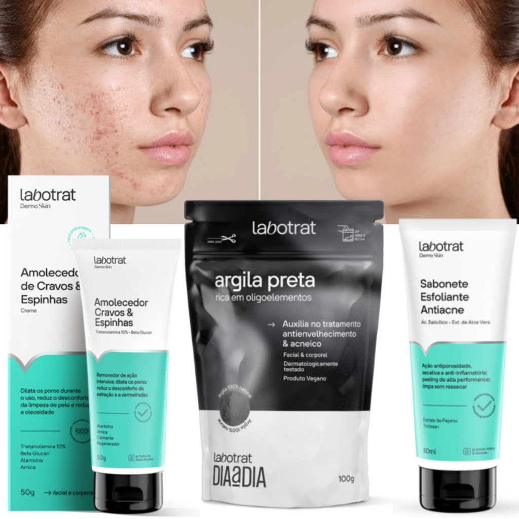 Skincare Antiacne Completo: Onde Comprar | BuscaProdutos