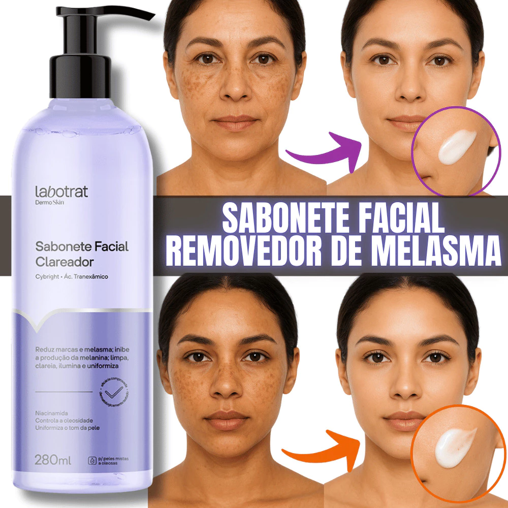 Clareador melasma sabonete manchas na pele e no rosto com acido tranexamico — imagem 1