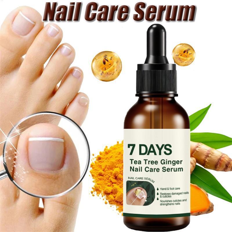 Óleo Para Cuidados Com As Unhas 30ml , Extratos Naturais Suaves , Nutritivo Profundo Renovação De Amarelas Descoloridas 