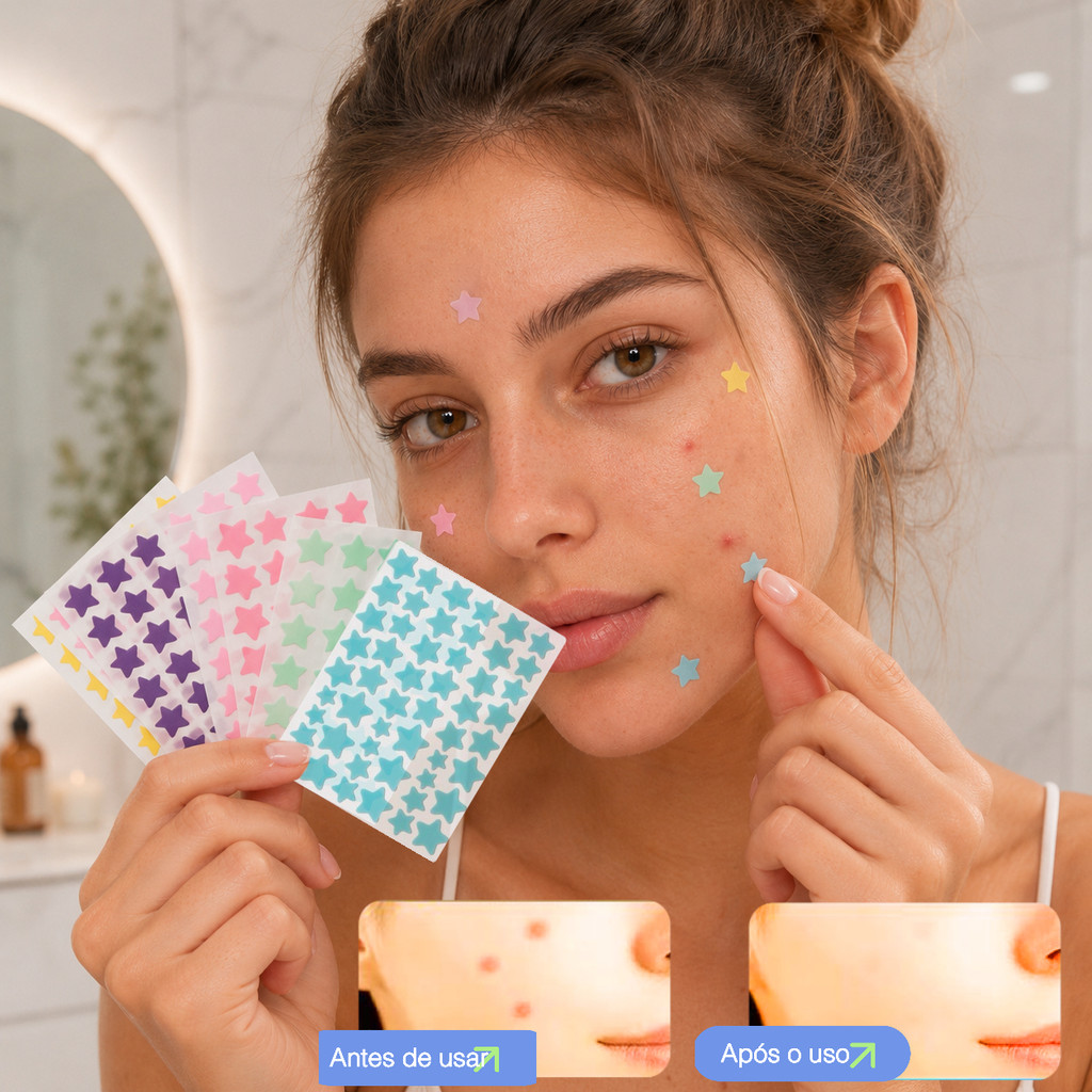 Kit 40/80/120 Adesivos Hidrocoloides para Acne Formato Estrela Coloridas 7 Cores Anti Espinha