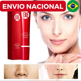 Creme forte original para remover manchas escuras/clareamento pigmentado/cuidados com a pele em Oferta na Shopee