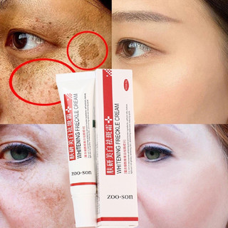O creme anti-manchas pode remover cloasma, acne, manchas pigmentares, melanina e manchas escuras, além de ter o efeito d