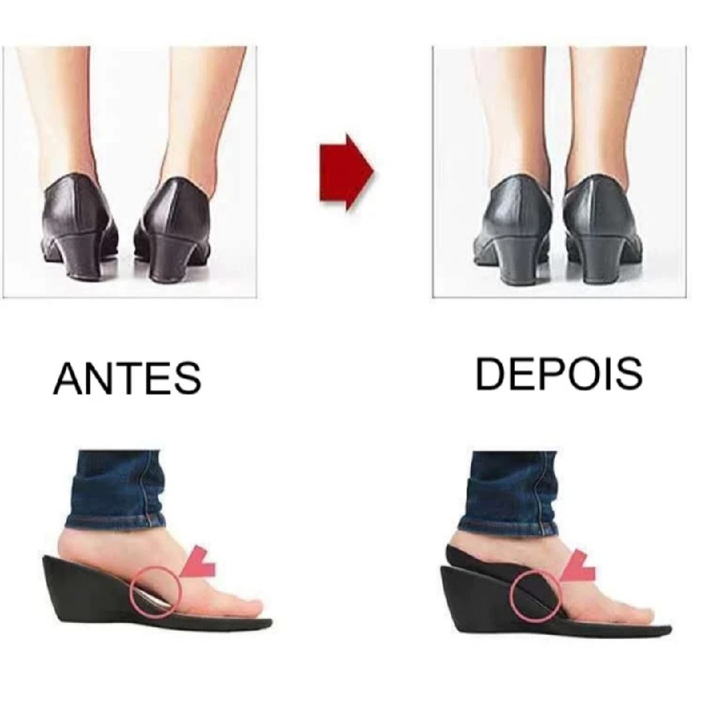 2 Pares Palmilha Corretora Pé Chato Alivio Correcao Pisada Evita Dor Fascite Plantar Ortopedico