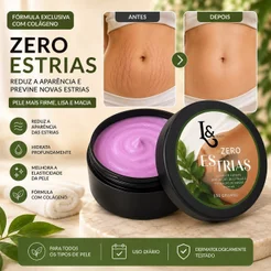 Creme Corporal Hidratante para Pele com Estrias 150g - L&Beauty